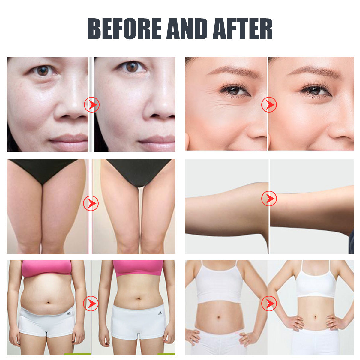 Mesin Kavitasi 40K, RF, Vakum & Pad Laser EMS SQ47B Pro 6-dalam-1
