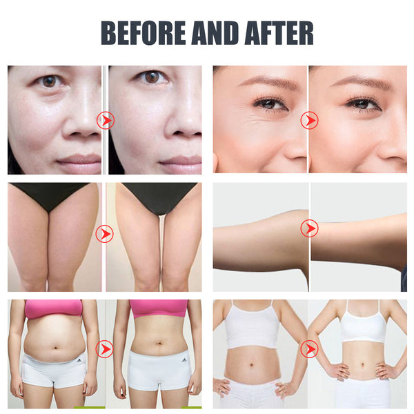 Mesin Kavitasi 40K, RF, Vakum & Pad Laser EMS SQ47B Pro 6-dalam-1