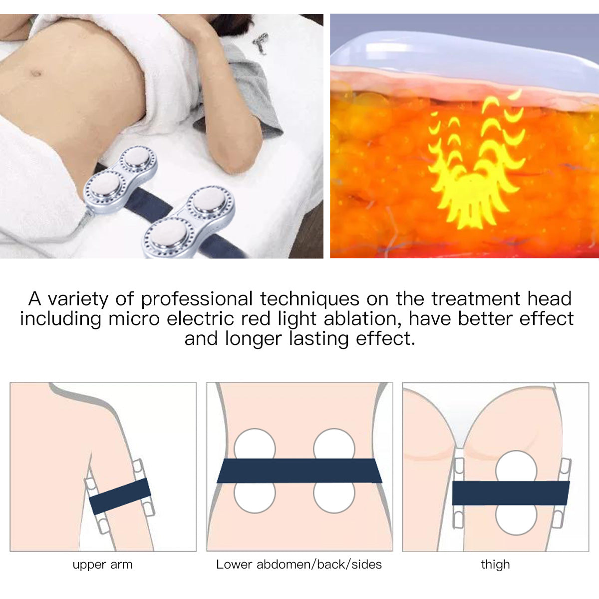 Mesin Kavitasi 40K, RF, Vakum & Pad Laser EMS SQ47B Pro 6-dalam-1